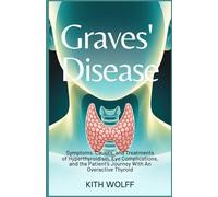 Graves’ Disease: Symptoms, Causes, and Treatments of Hyperthyroidism, Eye Complications, and the Patient’s Journey with an Overactive Thyroid