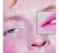 Greeting Committee - Dandelion