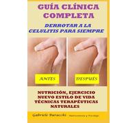 GUÍA CLÍNICA COMPLETA. DERROTAR A LA CELULITIS PARA SIEMPRE. NUTRICIÓN, EJERCICIO, NUEVO ESTILO DE VIDA, TÉCNICAS TERAPÉUTICAS NATURALES BASADO EN DATOS CIENTÍFICOS