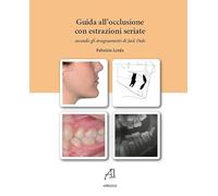 Guida all'occlusione con estrazioni seriate secondo gli insegnamenti di Jack Dale