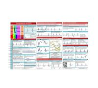 Guida tascabile ECG, carta tascabile ECG, interpretazione del ritmo ECG, carta di riferimento compatta e portatile su entrambi i lati, schede flash paramedici, interpretazione rapida Guida tascabile