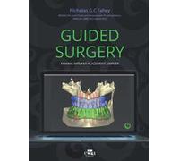 Guided surgery. Making implant placement simpler