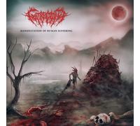 Gutrectomy Manifestation Of Human Suffering (CD)