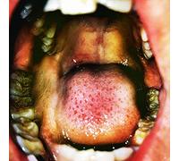 Hana Vu - Public Storage (Vinyl Clear & White Marbled)