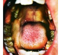 Hana Vu Public Storage (Vinyl LP) 12" Album Coloured Vinyl (Limited Edition)