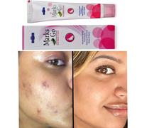 Hapdco Marks Go Cream 25 g Aiuta a rimuovere macchie, occhiaie e segni di ust...