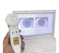 HD Iris Camera Iris Analyzer Telecamera Per Iridologia Con Obiettivo Hd 30x Iris, Rilevatore Di Iris Tipo Computer 2 Milioni Pixel, Interruttore Di Illuminazione Sinistro, Lente Ingrandimento Iride