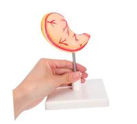 HEALSOPTHY Modello Anatomico Dello Stomaco Per Istruzione Studio Biologia Materiale Robusto Facile Assemblaggio Uso Clinico e Didattico
