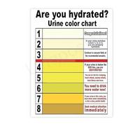 Health Reference Poster Urine Color Hydration Guide Chart Canvas Wall Art for Bathroom Gym Home Decor(Unframed,08x12inch(20x30cm))