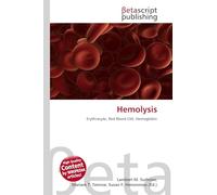 Hemolysis: Erythrocyte, Red Blood Cell, Hemoglobin