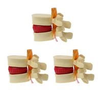Hfgdnchva 3X Vertebre Lombari Modello Anatomico Colonna Vertebrale Lombare del Disco Anatomia Strumento Didattico Modello Vertebre Lombari