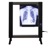 HGAYUBDV Lettore di pellicole radiografiche, visualizzatore di pellicole radiografiche, illuminatore di pellicole a LED dimmerabile, Pannello in Acrilico e Telaio in Alluminio, luminosità Regolabile