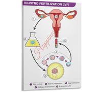HGETJOHXEM IVF In Vitro Fertilization Procedure Chart Poster Fertility Steps Diagram Educational Canvas Wall-Art Living Room Bedroom(Unframed,12x18inch(30x45cm))