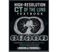 High-Resolution CT of the Lung Textbook: An Illustrated Guide to Normal Anatomy, Common Pulmonary Patterns, Interstitial Lung Disease, Nodules, Infections, Emphysema & Practical CT Interpretation