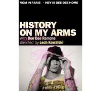 History on my arms