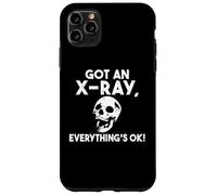 Ho una radiografia, va tutto bene Custodia per iPhone 11 Pro Max