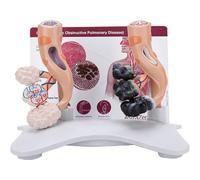 hocvseo Modello Anatomico Alveolare Umano, Modello di Confronto Alveoli Fumatori E Alveoli Sani, Struttura Alveolare Ingrandita, con Scheda Posteriore Inglese, per L'insegnamento Medico