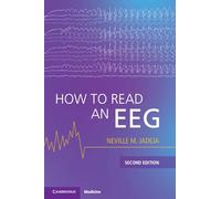 How to Read an EEG