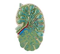 HUIBBGO Microstruttura del linfonodo Modello del linfonodo Modello didattico di biologia La Forma è realistica Modello di Campione Medico Modello dimostrativo didattico di Anatomia