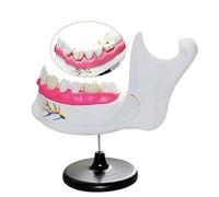 HUIBBGO Modelli Medici, Modello di Denti dentali, Modello di Anatomia della dentizione e dei molari, Modello di Denti dimostrativi per l'educazione del paziente, Supporto alla Formazione d