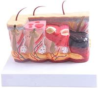 HUIBBGO Modello anatomico della Pelle Umana ustionata - Modello anatomico Medico della Pelle - Compatibile con la didattica di Ricerca e didattica, Supporto formativo per l'istruzione Medi