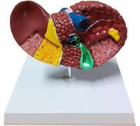 HUIBBGO Modello di fegato Umano 1:1 Modello didattico di Anatomia Sistema digerente espositivo Medico Anatomia patologica del fegato Ausili didattici Modello di fegato patologico - Modello