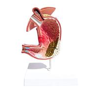 HUIBBGO Modello di Stomaco Umano - Modello di Anatomia delle malattie dello Stomaco - Modello di Anatomia didattica dell'apparato digerente Umano - Materiale didattico per la Scuola