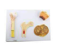 HUIBBGO Modello di Struttura ossea Osso Compatto spongioso Anatomia Umana Modello strutturale dell'osso Osso spongioso Osso Denso e Sistema femorale Risorse didattiche e di Laboratorio