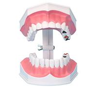 HUIBBGO Modello didattico Mark 2X Ingrandisci Modello di Denti per insegnare ai Bambini Modello Dentale con Lingua Asilo Nido Spazzola Denti Attrezzatura didattica Modello Medico