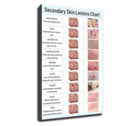 Human Skin Anatomy Poster Dermatology Chart Educational Wall Art for Science Classroom Biology Teacher and Medical Student(Framed,12x18inch(30x45cm))