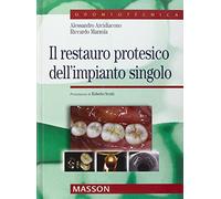 Il restauro protesico dell'impianto singolo