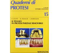 Il titanio in protesi parziale rimovibile