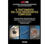 Il trattamento del caso endodontico complesso