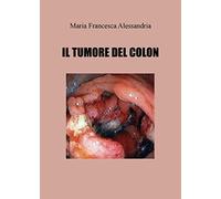 Il tumore del colon