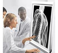 Illuminatore for pellicole radiografiche, oscuramento continuo al tocco, con staffa e piastra guida luce acrilica, senza ombre, for ospedale clinico