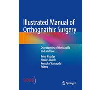Illustrated Manual of Orthognathic Surgery: Osteotomies of the Maxilla and Midface