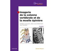 Imagerie De La Colonne Vertébrale Et De La Moelle Épinière