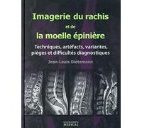 Imagerie du rachis et de la moelle épinière: Techniques, artéfacts, variantes, pièges et difficultés diagnostiques