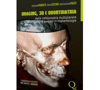 Imaging, 3D e odontoiatria. Dalla cefalometria multiplanare alla