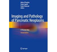 Imaging and Pathology of Pancreatic Neoplasms: A Pictorial Atlas