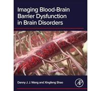 Imaging Blood-Brain Barrier Dysfunction in Brain Disorders