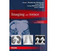 Imaging del torace