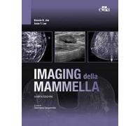 Imaging della mammella