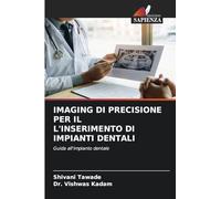 IMAGING DI PRECISIONE PER IL L'INSERIMENTO DI IMPIANTI DENTALI: Guida all'impianto dentale