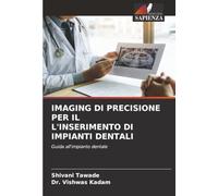 IMAGING DI PRECISIONE PER IL L'INSERIMENTO DI IMPIANTI DENTALI: Guida all'impianto dentale