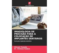 IMAGIOLOGIA DE PRECISÃO PARA A COLOCAÇÃO DE IMPLANTES DENTÁRIOS: Guia para implantes dentários