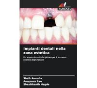 Impianti dentali nella zona estetica: Un approccio multidisciplinare per il successo estetico degli impianti