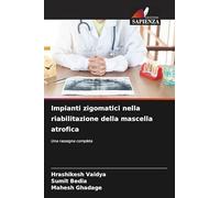 Impianti zigomatici nella riabilitazione della mascella atrofica: Una rassegna completa