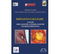 Impianto cocleare. Cause organiche e inorganiche di reintervento. Ediz. illustrata