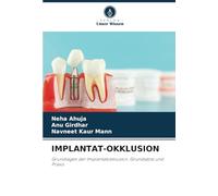 IMPLANTAT-OKKLUSION: Grundlagen der Implantatokklusion: Grundsätze und Praxis